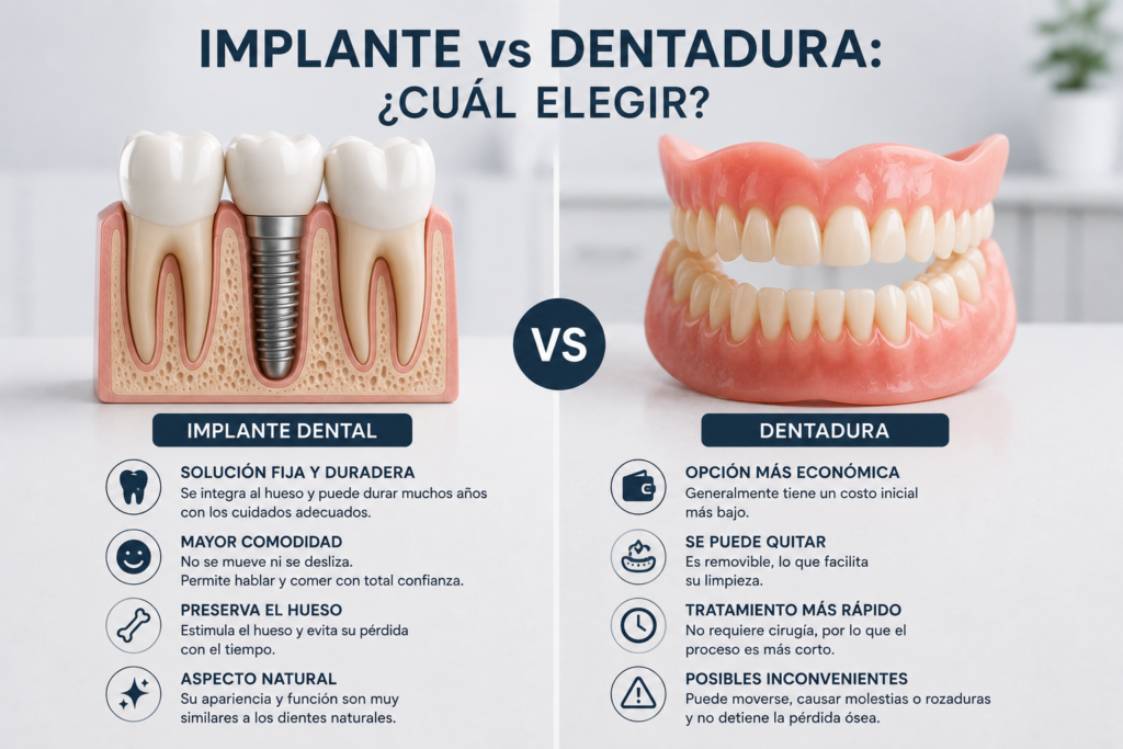 implante vs dentadura